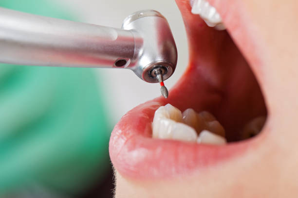 Best Tooth Pain Emergency Relief  in St Francisville, LA
